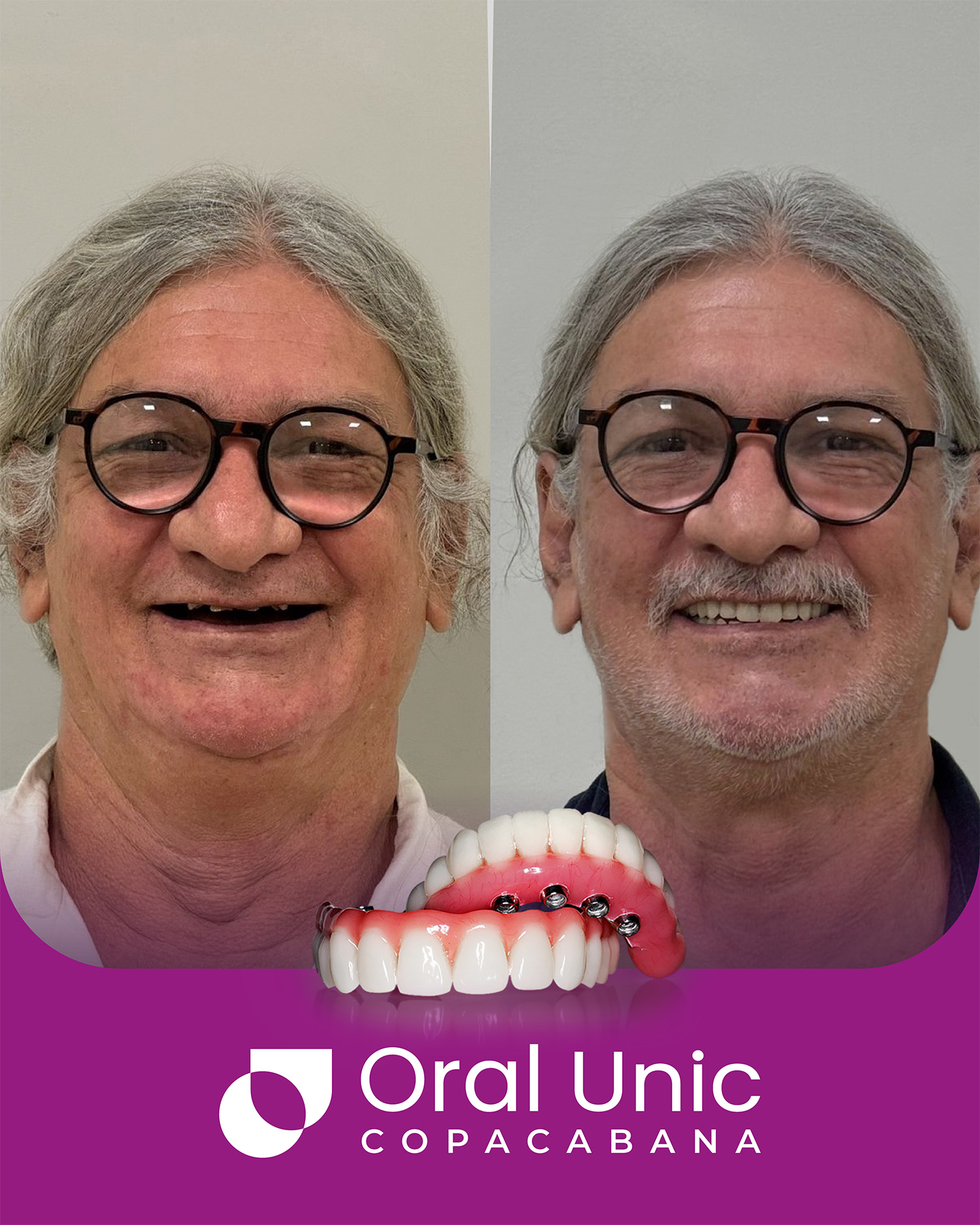 Antes e depois Oral Unic - COPACABANA 1
