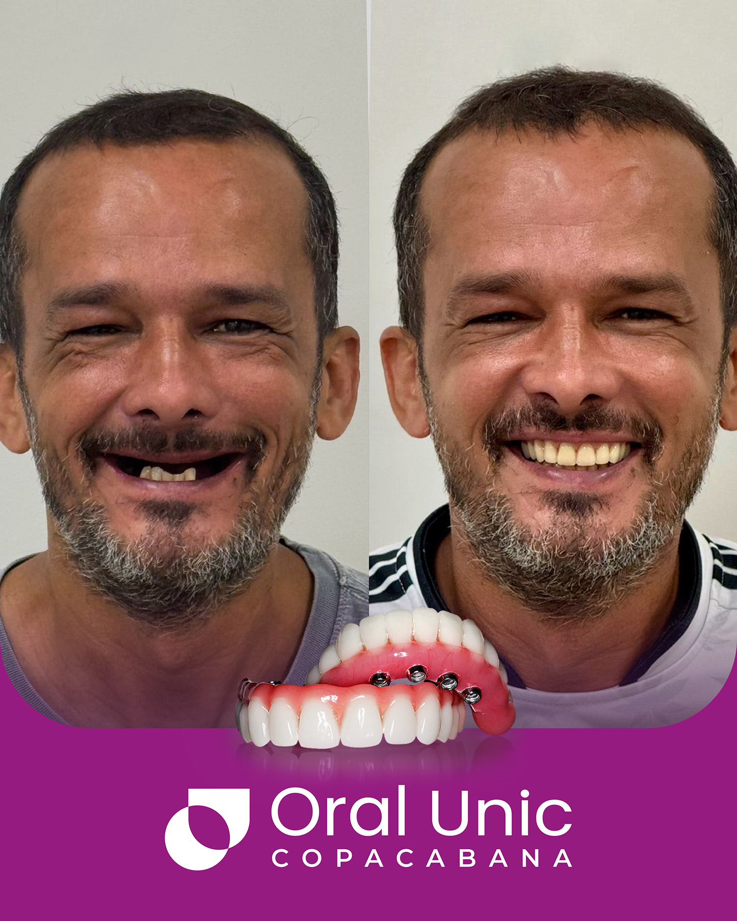 Antes e depois Oral Unic - COPACABANA 2