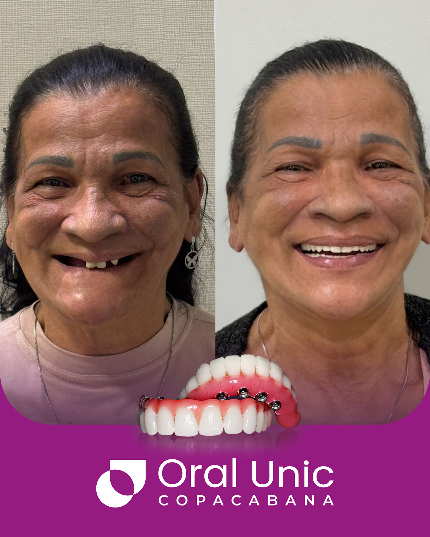 Antes e depois Oral Unic - COPACABANA 3