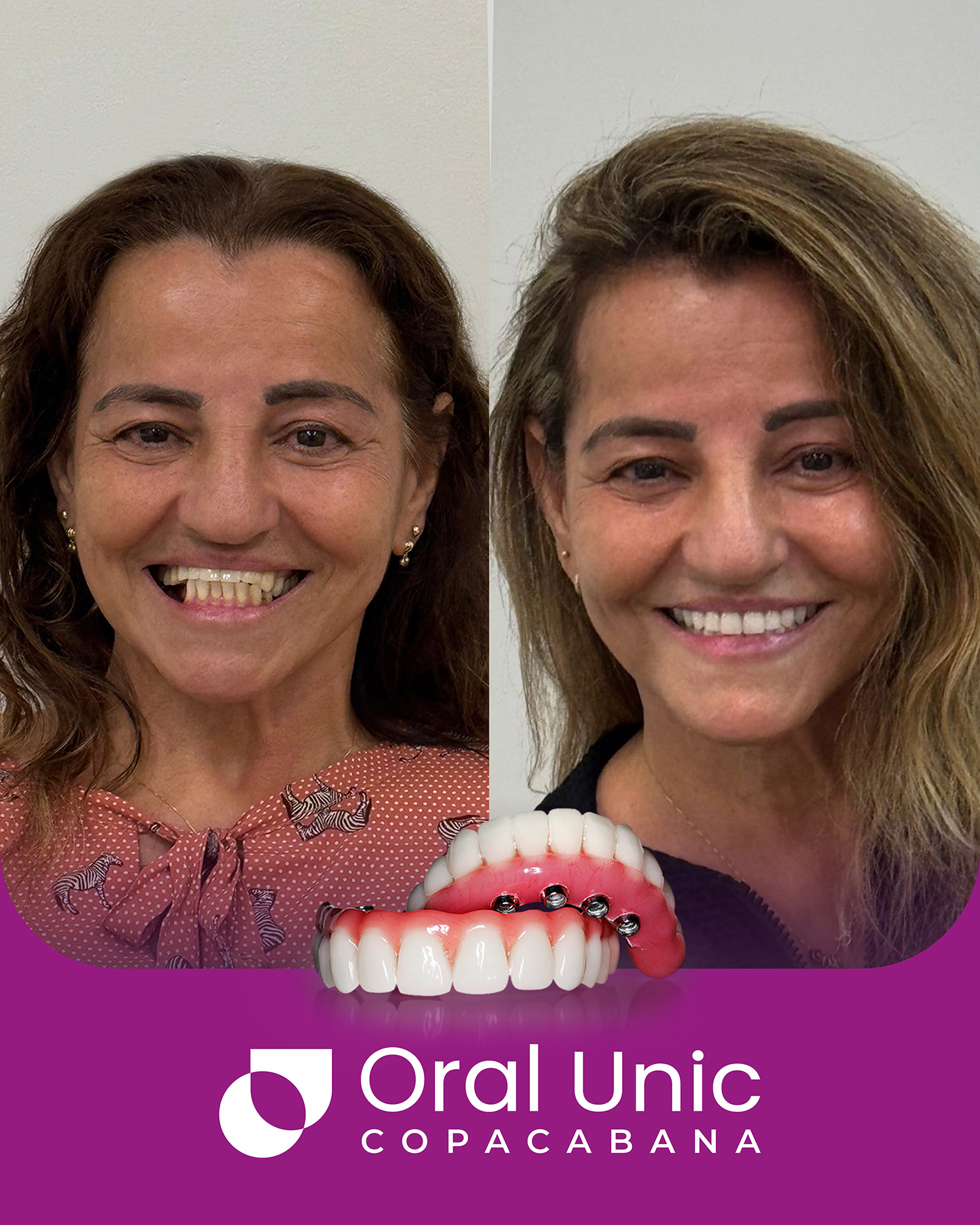 Antes e depois Oral Unic - COPACABANA 4